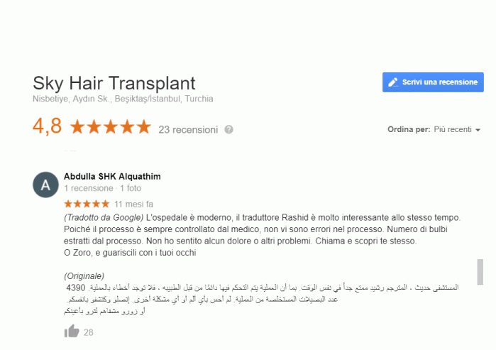 recensione dopo il trapianto di capelli